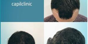 CapilClinic