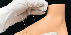 Centro de Acupuntura Dr.Iturralde