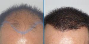 Medical Hair